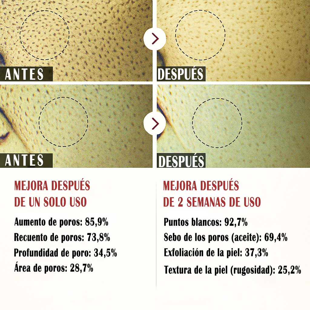 Últimas 3 horas: 70 % de descuento🔥 Exfoliante suave Glow Rice Ampoule - Apto para todo tipo de piel