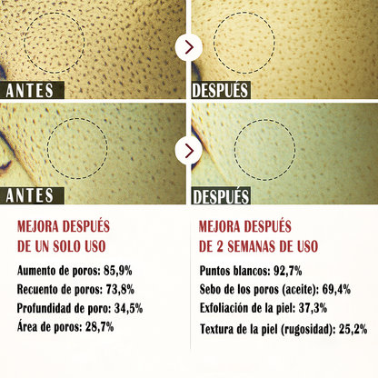 Últimas 3 horas: 70 % de descuento🔥 Exfoliante suave Glow Rice Ampoule - Apto para todo tipo de piel