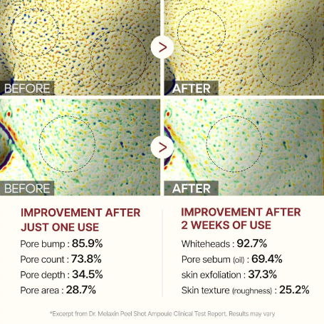 1 Final 3 Hours: 70% OFF🔥 Gentle Exfoliator Glow Rice Ampoule-Suitable for All Skin Types (副本)