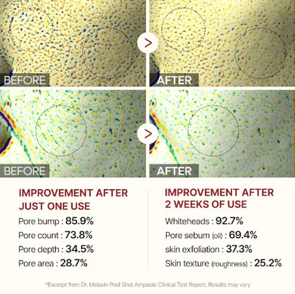 1 Final 3 Hours: 70% OFF🔥 Gentle Exfoliator Glow Rice Ampoule-Suitable for All Skin Types (副本)