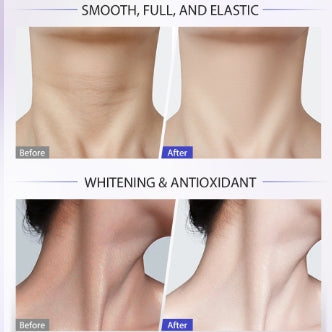 ECK ighten &amp; Lift Neck Cream  Revolutionizing Neck Skincare