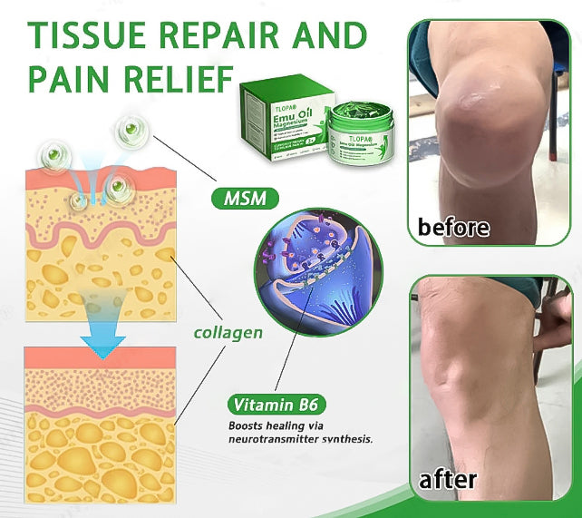 🦵TLOPA®Advanced Magnesium & Emu oilMassage Pain Relief cel（🏆The Ultimate Solutionfor Muscle Aches Arthritis Joint Pain Nerve Pain Inflammation andStiffness)-Made inAustralia