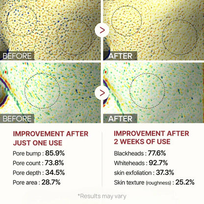 Final 3 Hours 70% OFF🔥 Gentle Exfoliator Glow Rice Ampoule-Suitable for All Skin Types