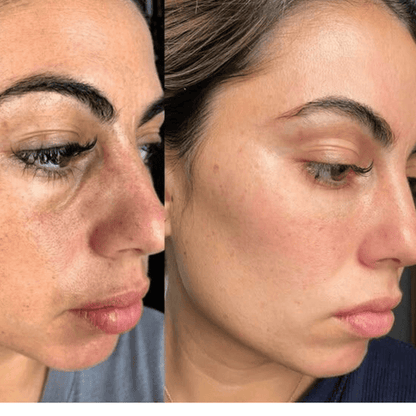 Final 3 Hours 70% OFF🔥 Gentle Exfoliator Glow Rice Ampoule-Suitable for All Skin Types