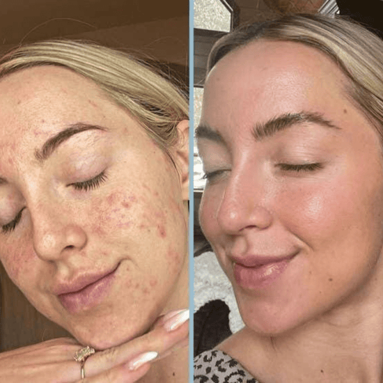 Final 3 Hours 70% OFF🔥 Gentle Exfoliator Glow Rice Ampoule-Suitable for All Skin Types