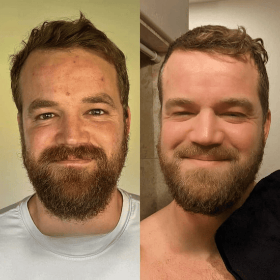 Final 3 Hours 70% OFF🔥 Gentle Exfoliator Glow Rice Ampoule-Suitable for All Skin Types