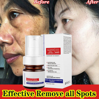 ⚡5-second brightening rescue: Dark spots disappear, blemishes fade, and skin becomes radiant! Vitamin C Whitening Freckles ESSENCE
